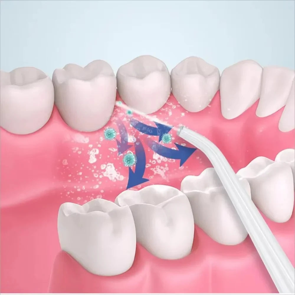 3-in-1 Electric Oral Irrigator – Water Flosser, Teeth Whitening & Gum Care